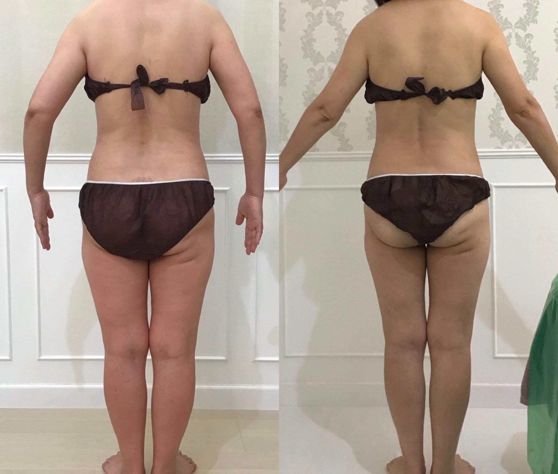 ダイエット専門店　ルイーズ　レヴｪ