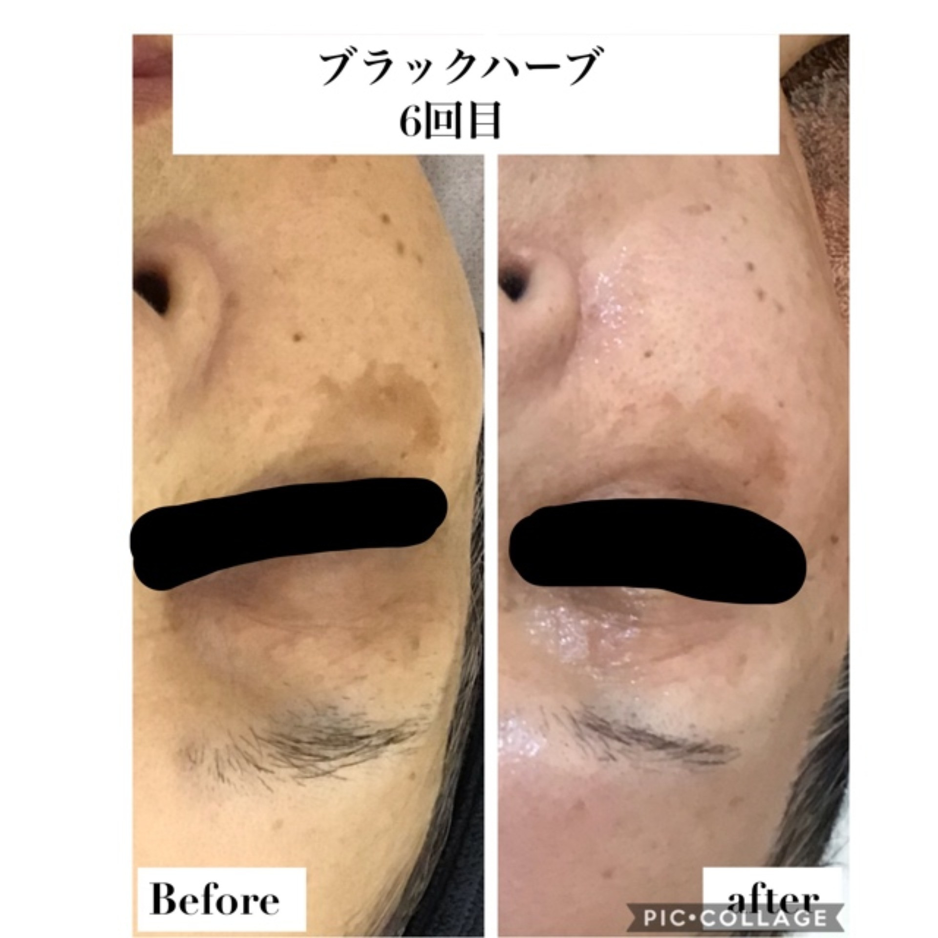 ハーブ専門店　ルイーズ　レヴェ