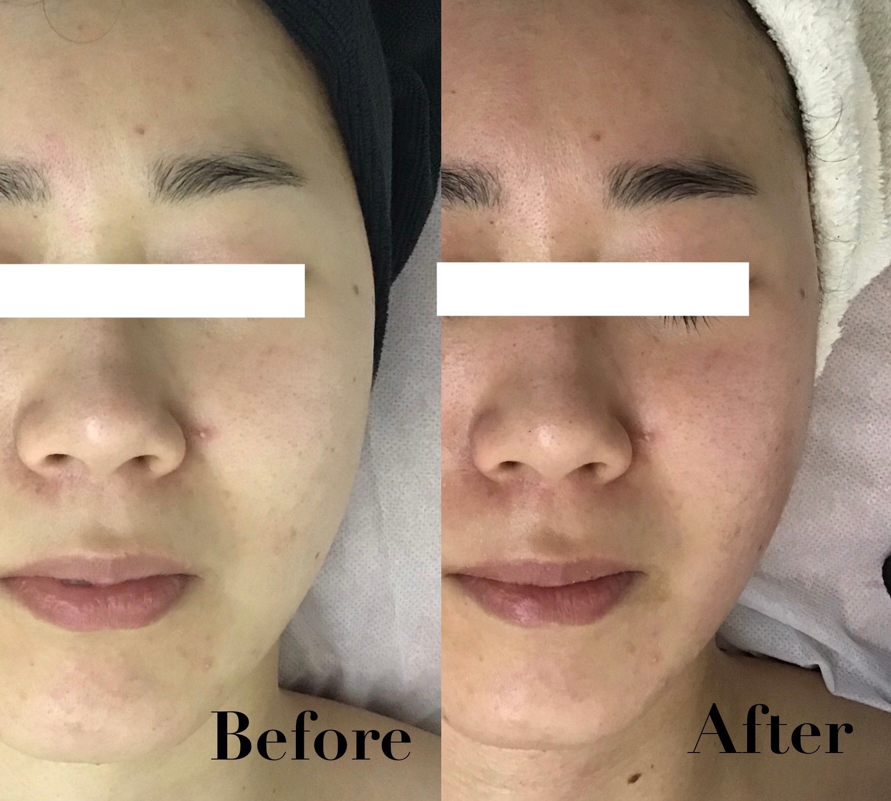 ハーブ専門店　ルイーズ　レヴェ