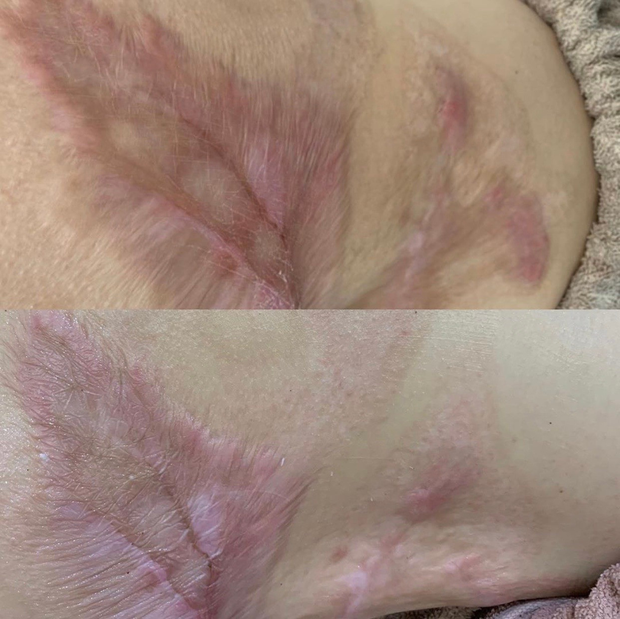 海南でハーブトリートメントをお探しなら