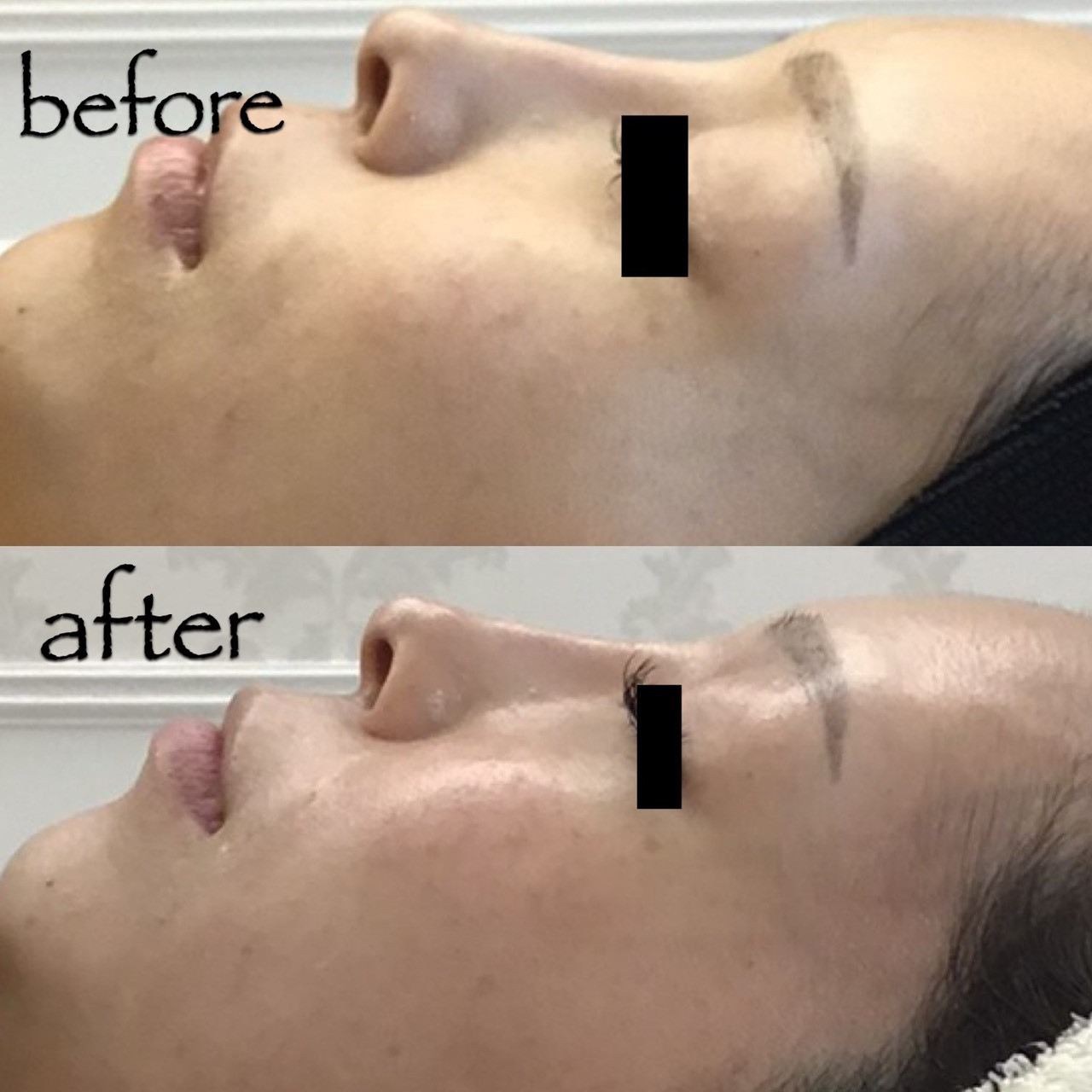 ハーブ専門店　ルイーズ　レヴェ