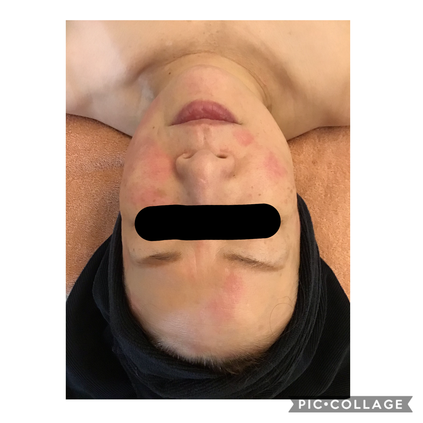 カームリバースケア